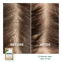 Klorane - Galangal Powder Mask 8x3g -The French Pharmacy 3282770100914 5