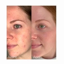 Caudalie - Vinopure Blemish Control Salicylic Serum 30ml -The French Pharmacy 344 serum vinopure 5