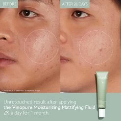 Caudalie - Vinopure Moisturising Mattifying Fluid 40ml -The French Pharmacy 5 vinopure fluid before after2 caudalie uk